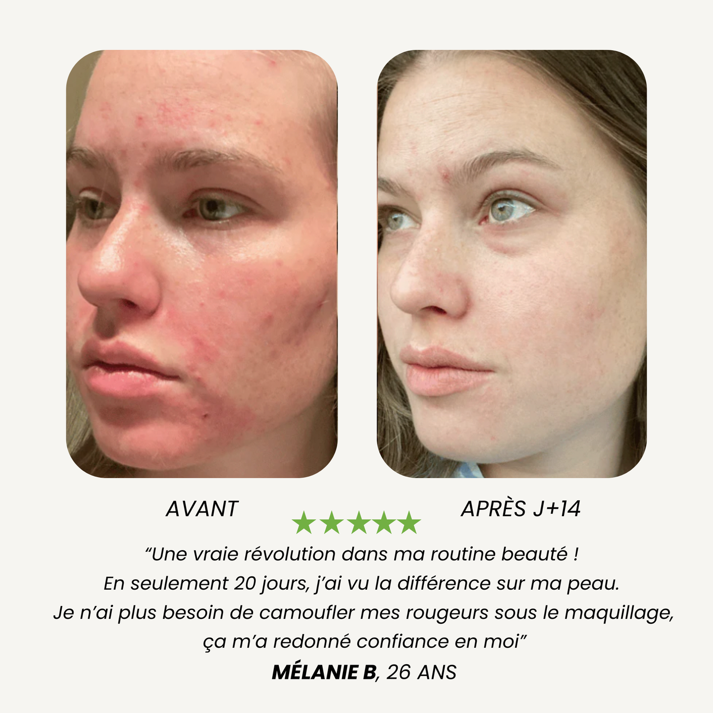 Pommeau de Douche Filtrant