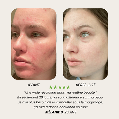 Pommeau de Douche Filtrant